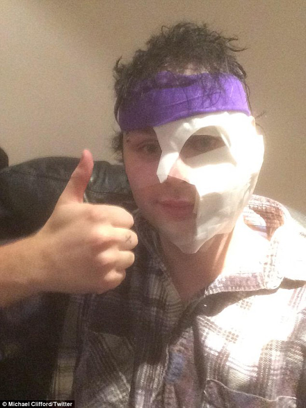 Michael of 5SOS Burned During Show in London