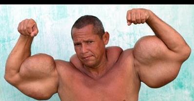 WATCH: This guys has one of the biggest biceps in the world